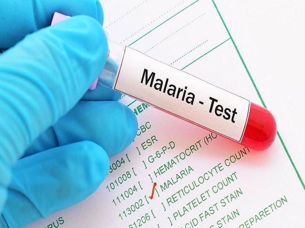 malaria test