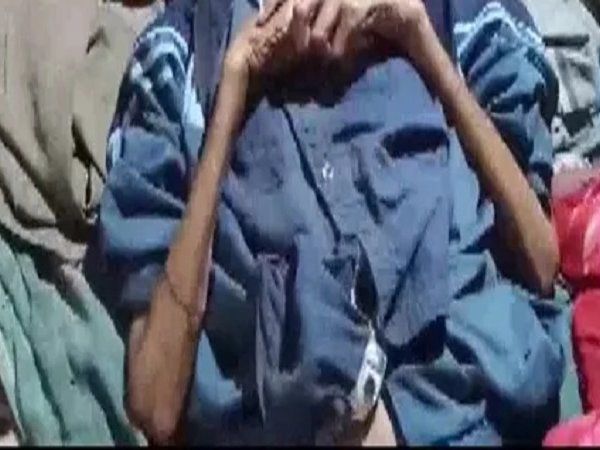 man died of starvation