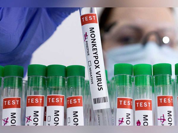 Delhi reports fifth case of monkeypox total number of cases in the country so far is 10