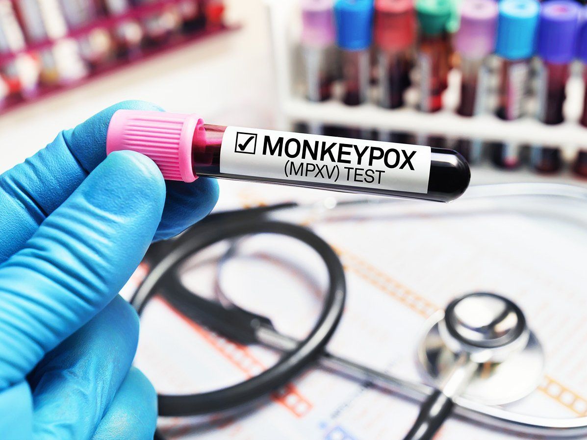 Monkeypox:इन 6 लक्षणों को न करें इग्नोर, हो सकता है मंकीपॉक्स का संक्रमण