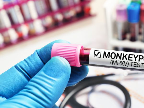 Monkeypox Vaccine kit