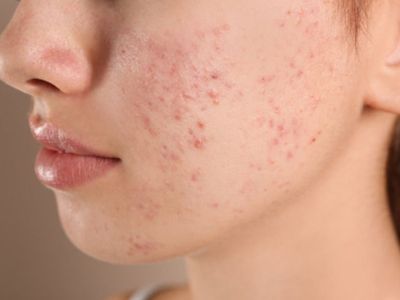 Monsoon Skin Care Monsoon Skin Care