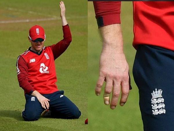 eoin morgan broken finger