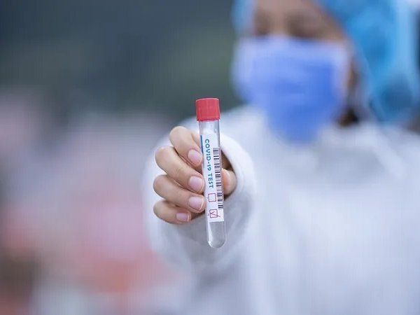 mp third minister found covid positive