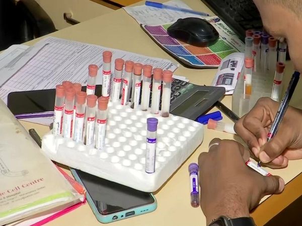 thalassemic children tested positive for HIV 