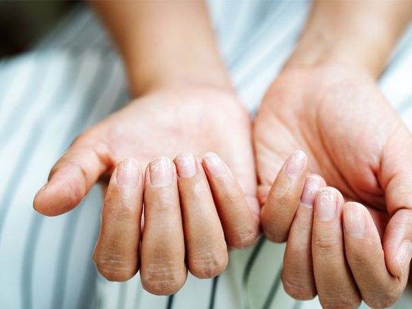 Be careful if the nails change for a while Is it because of Covid?