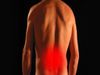 natural remedy for back pain
