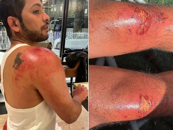 Khatron Ke Khiladi 12 update: Nishant Bhat gets injured while performing a stunt for Rohit Shetty Tv Show- 