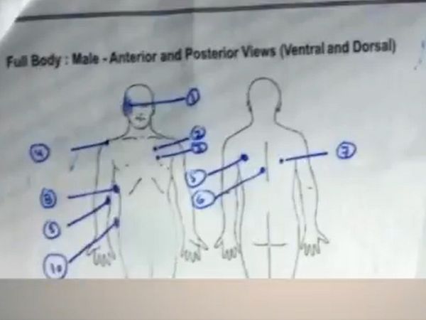 Vikas Dubey Post Mortem Report