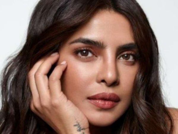 Priyanka Chopra shares a BRUISED look face, fans are shocked