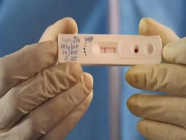 1, 2  और तीन मई को कोरोना मामलों पर डालें नजर, कहीं ढील पड़ न जाए भारी