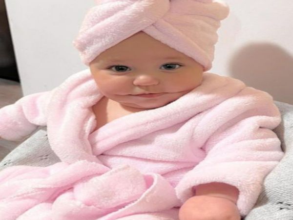 Baby Born With Rare Condition With Permanent Smile Know About Truth