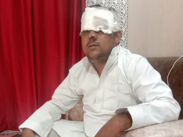 Saharanpur: Muslim youth alleges attack after he distributed fruits & water to Kanwariyas