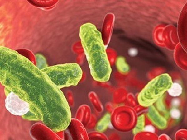 Spetic Shock Meaning in Hindi