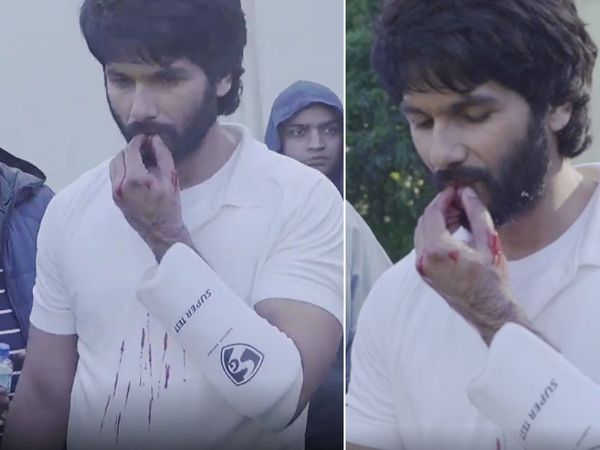 Jersey Actor Shahid Kapoor Badly Injured WATCH VIDEO