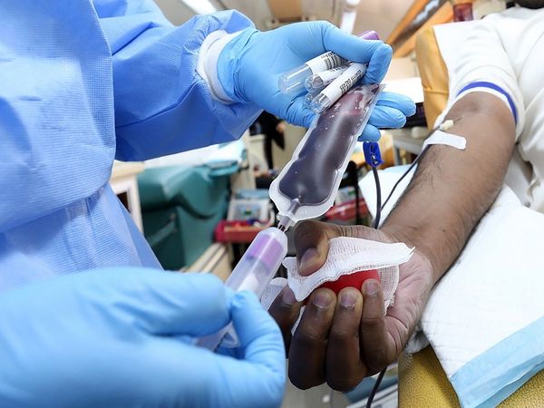 side effect of plasma therapy