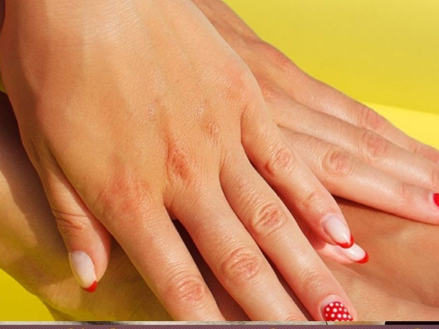 Skin Care Tips: तेज धूप से हाथों का रंग पड़ गया है काला? इन टिप्स की बदौलत हाथ बन जाएंगे पहले जैसे