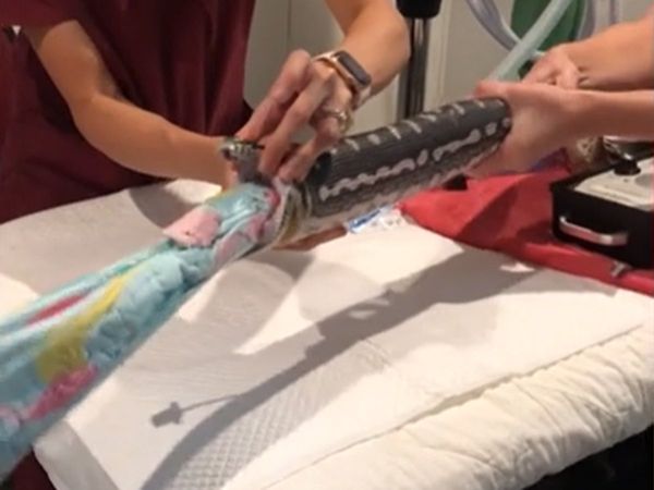 Doctors pull entire beach towel out of python's mouth in austrailiya