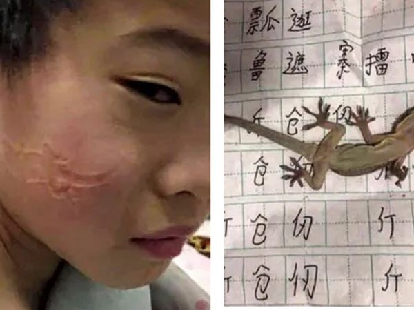 होमवर्क करते-करते छिपकली पर सो गया बच्‍चा, नींद खुली तो शीशे में चेहरा देखकर उड़ गए होश