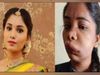 Swathi Sathish Kannada actress face swollen after root canal Surgery -