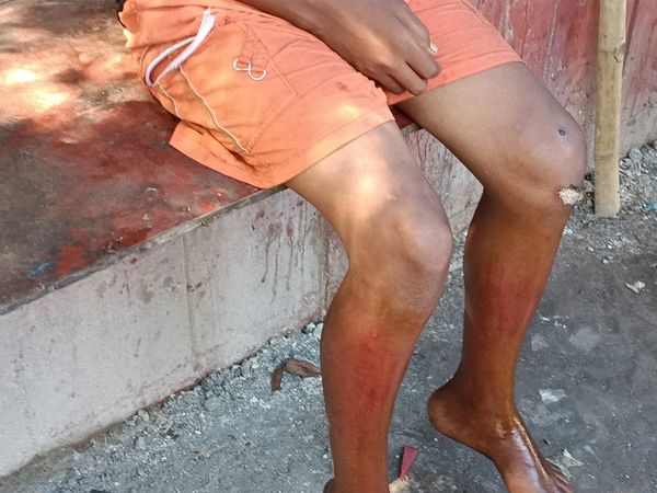 patna policemen poures hot tea on child