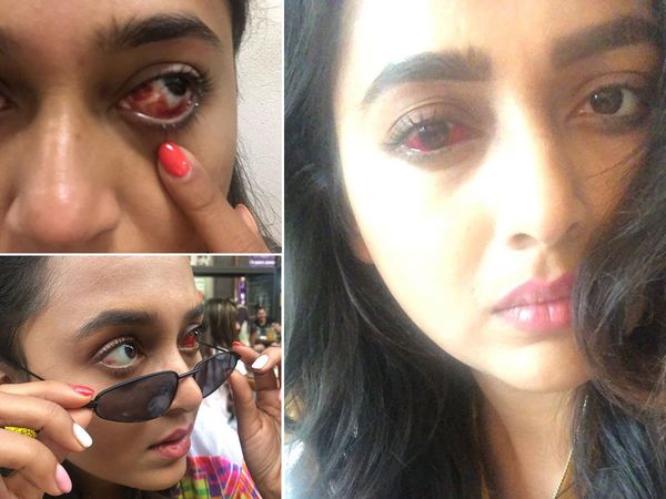 Shantanu maheshwari khatron ke khiladi Winner And Fans Upset tv actress tejaswi prakash Exit