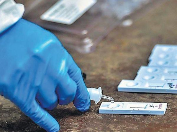 Know all gene rt pcr test it catches new strain of corona