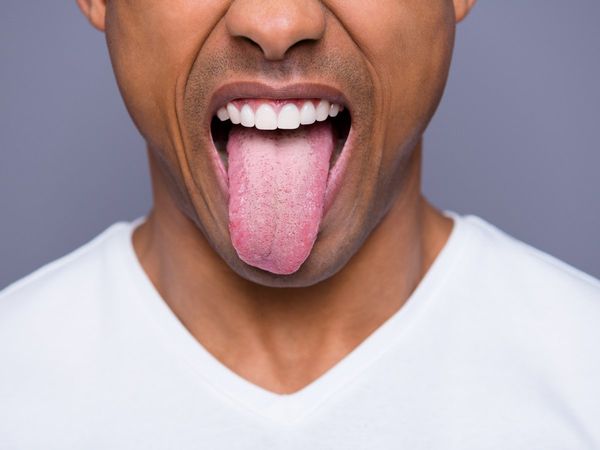 what does tongue color say about your health, what does tongue say about your state of health, what your tongue say about your health, जीभ का अलग रंग क्या संकेत देता है,
