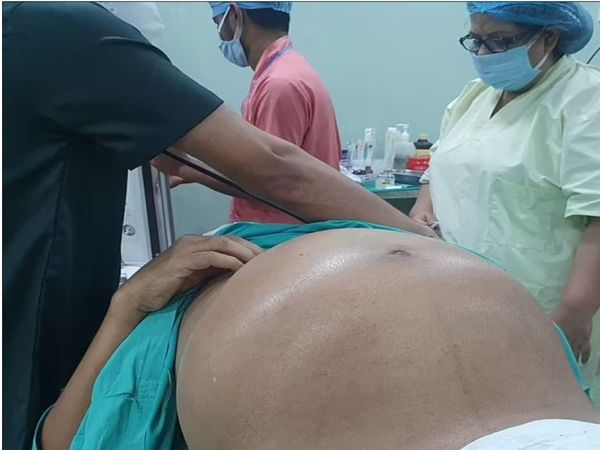 10 kg Tumour removed from Kolkata man arnab stomach look like pregnant 