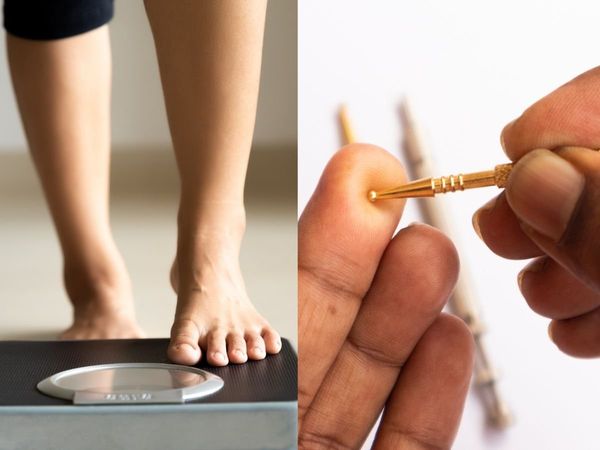 Acupressure for weight loss