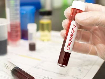 what to do if covid test is negative but still have symptoms, what to do if you test negative for covid have symptoms, what if my covid test is negative but i still have symptoms, what to do if you have covid symptoms but test negative, can you test negat
