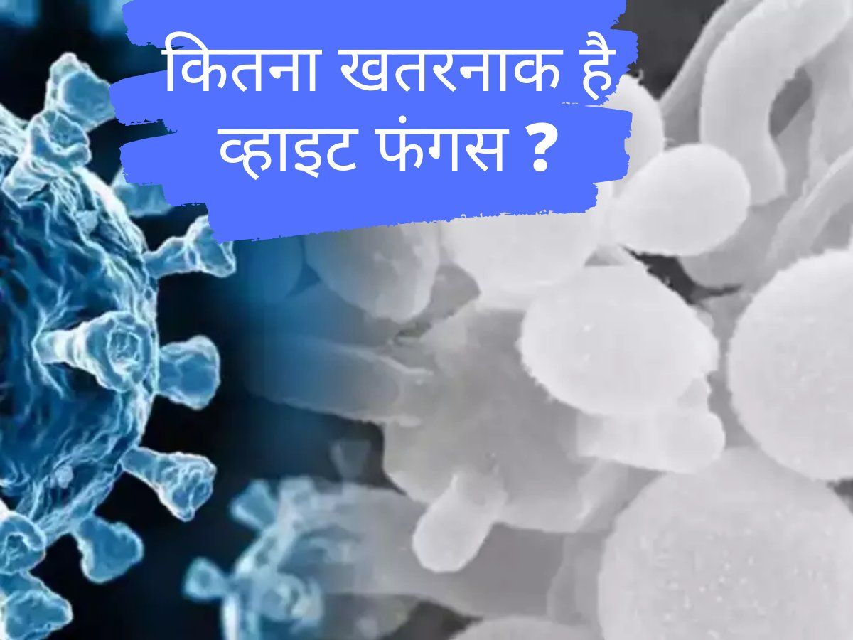 white fungus covid: कितना खतरनाक है व्हाइट फंगस, कोविड 19 के साथ क्यों माना जा रहा है जानलेवा