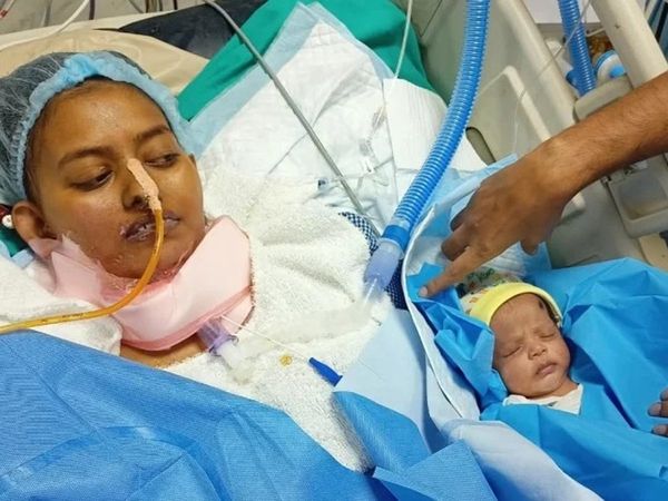 Yogi Govt sanctions financial help for lung transplant of frontline woman doc