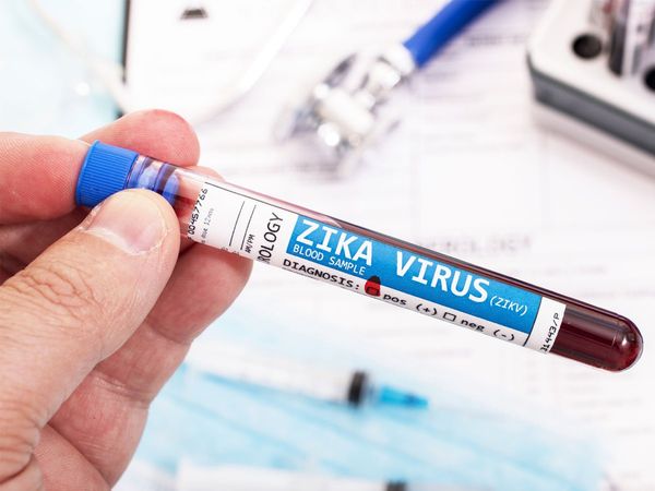 Zika virus