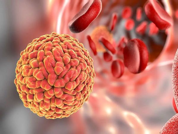 zika virus, zika virus symptoms, zika virus is spread by, what is zika virus, zika virus in kerala, zika virus disease, zika virus kerala, zika virus in india