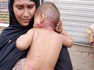 Fact Check This child was not beatan by UP police during CAA protest, she is from Pakistan