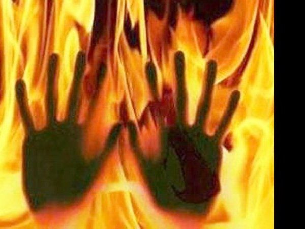 Fatehpur: रेप के बाद युवती को जिंदा जलाया, कानपुर के अस्पताल में मौत