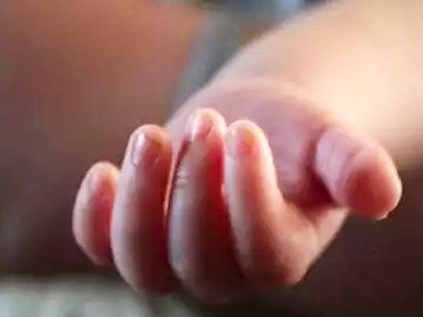 Representational Image