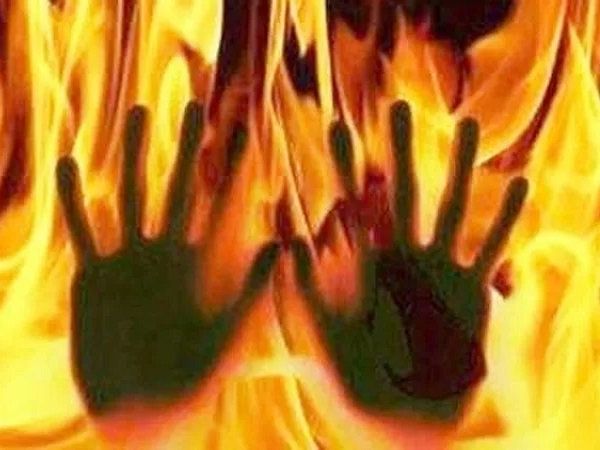 woman set her on fire