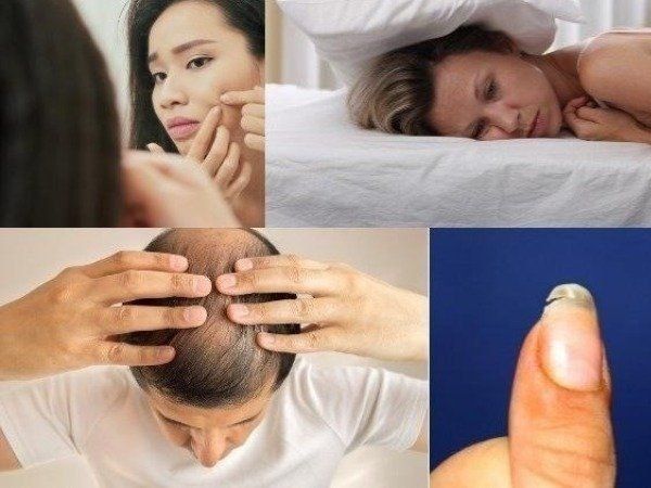 Signs and symptoms of vitamin c deficiency 